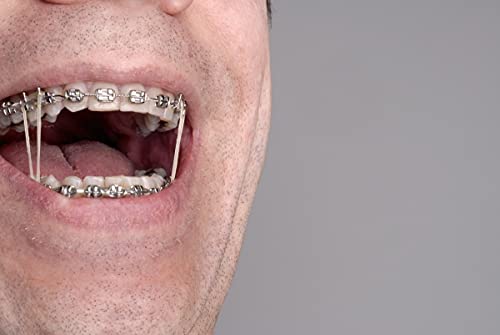 500 Pcs Orthodontic Elastic Rubber Bands, 3.5 Ounces Heavy Dental Rubber Traction Bands, Free Elastic Placer For Braces (1/8",Chipmunk) #TOP6