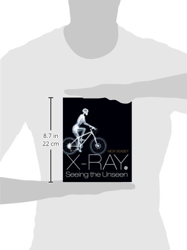 X Ray: Seeing the unseen