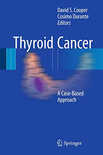 Thyroid Cancer view 2