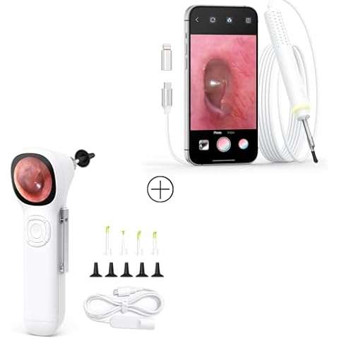 ScopeAround Digital Otoscope, 720p HD Smart Visual Ear Camera, Ear Scope Otoscope Camera with 6 LED Lights, Ear Wax Removal Tool Camera Cover