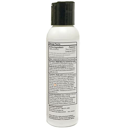 Image of Naturasil Tinea Versicolor Treatment Lotion - Max-Strength 10x Sulfur Lotion for Fast-Acting Antifungal Relief | Soothes and Restores Skin Health 113g