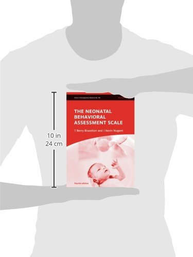 Neonatal Behavioral Assessment Scale: 190 (Clinics in Developmental Medicine)