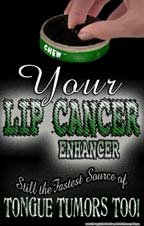Poster #153 Chew, Your Lip Cancer Enhancer: Anti-Tobacco Use Poster for Teens