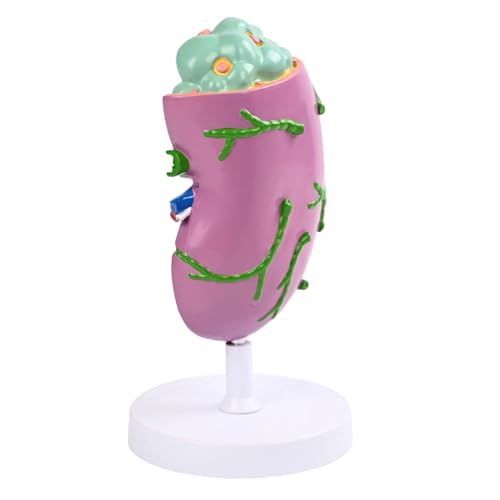 Modèle de structure lymphatique humaine avec code couleur pour enseignement