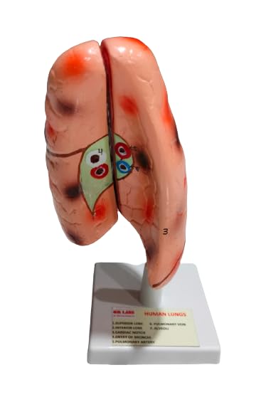 Human Lungs On Stand Brand OM Labs-image-33