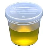 Globe Scientific 5917 Polypropylene Graduated Specimen Container with Polyethylene Separate Snap Cap, 5 oz Capacity (Case of 300)
