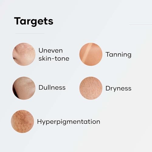 Image of Cureskin Radiance Body Soap | For Pigmentation & Sun Damage with Alpha Arbutin, Kojic Acid and Ucuba Butter | Soap Tan Removal, 75 g (Pack of 6)