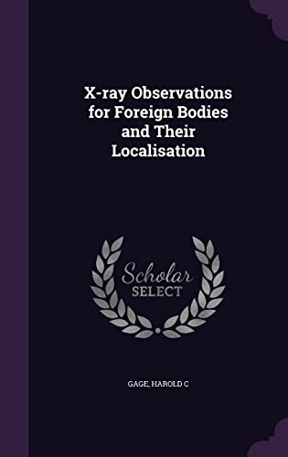 X-ray Observations for Foreign Bodies and Their Localisation