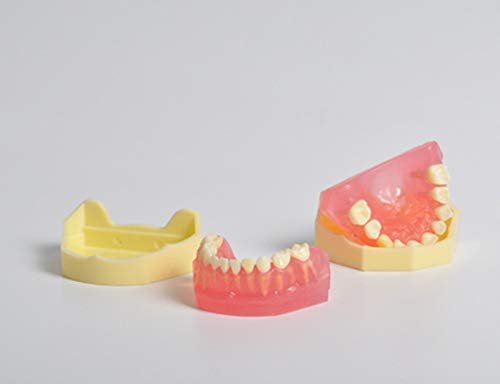 Dental Study Model Children Kids Primary Removable Teeth Pit Fissure Sealant Communication (Removable teeth)