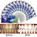 Sparkling White Smiles Advanced Teeth Whitening Strips 28 Count(14 Upper and 14 Lower Strips) Compare to Major Brands and Save.