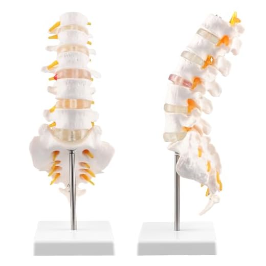 QWORK® Modelo Anatómico de Columna Lumbar con Sacro Abierto, Tamaño Natural 1:1, para Enseñanza, Estudio y Demostración