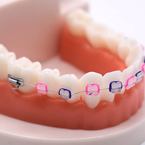 Angzhili 1 Piece Dental Demonstration Orthodontic Model with Metal Wires and Ceramic Bracket,Dental Teaching Teeth Model for Typodont
