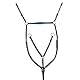 HKM Hilfszügel-620791000644 schwarz One Size