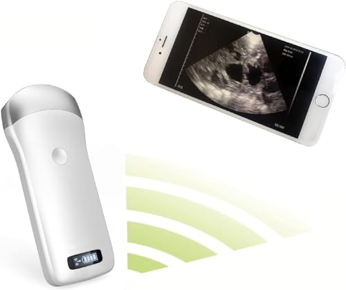 Escáner de ultrasonido inalámbrico portátil, sonda de instrumento de diagnóstico de embarazo veterinario, teléfonos inteligentes compatibles, tableta, for cerdos y ovejas (teléfono móvil no incluido)