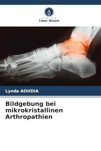 Bildgebung bei mikrokristallinen Arthropathien: DE
