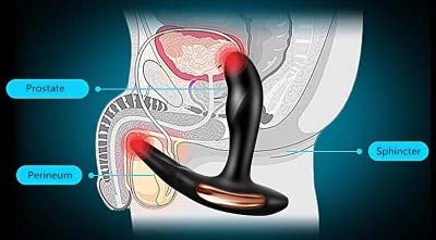 Massageador de Próstata com Controle Wireless, 7 Modos de Vibração - KATRINE DIBE - DB039