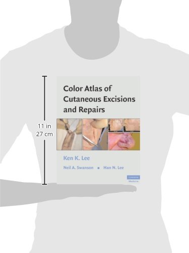 Color Atlas of Cutaneous Excisions and Repairs