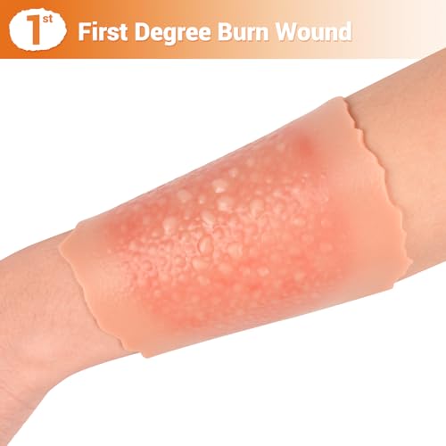 Image of Burn Wound Packing Trainer, Burn Moulage, Adhesive Skin Burn Wound Trainer for Wound Care Training, First Degree Burn Wound Training Model