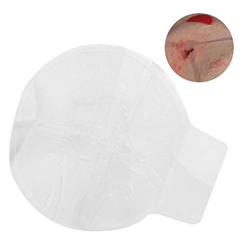 Vikenar Sigillo toracico, Gel di silice