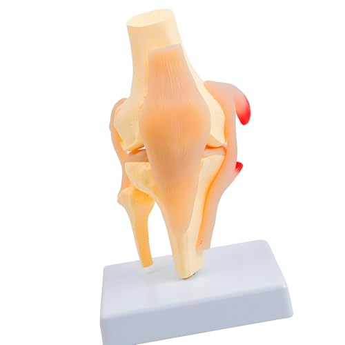Modelo anatómico de rótula de rodilla: la solución visual para explicar lesiones ligamentosas 5
