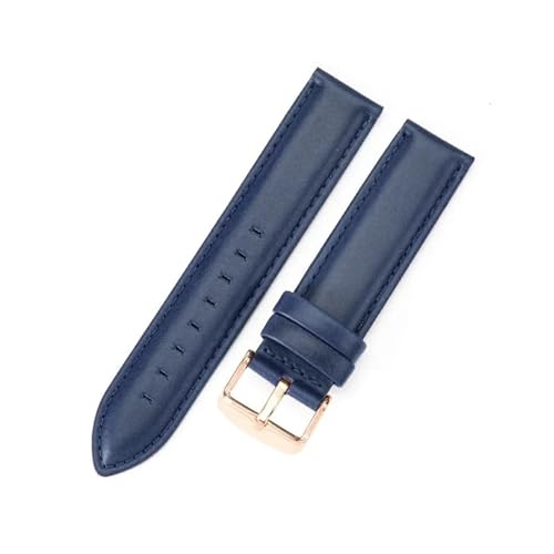 EDVENA rvXgbv fB[X {vrvoh 12/13mm 14mm 17mm 18mm 19mm 20mm 22mm Y(Blue-RoseGold,20mm)