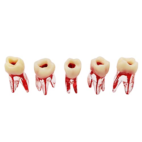 Debksgeoti DEBKSGEOTI-M8008-36#-10 Dental Root Canal Pulp Cavity Practice Endodontic Pulp-Opened Rct Teeth Model M8008 16# Typodont Standard 1:1 Teach Study 5 Pcs cover