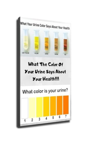 Póster de color de la orina para deshidratación, monitor de salud y arte de pared para clínica