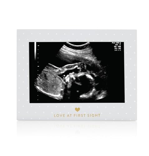 Pearhead Little Blossoms Love At First Sight Sonogram Picture Frame, Ultraound Pregnancy Keepsake, Gender-Neutral Nursery Décor For Baby Girl or Baby Boy, Polka Dot, 6.94x5.25x.75 Inch (Pack of 1)