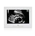 Little Blossoms by Pearhead Keepsake Sonogram Picture Frame, Baby Ultrasound Frame, Expecting Parents Gift, Baby Shower Gift, Gray Polka Dots