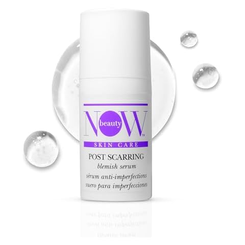 NOW BEAUTY Acne Serum for Face - Treats Breakouts for Smooth, Flawless Skin - All-Over Daily Acne Treatment for Blemishes - Powerful, Preventative Anti Acne Serum - 1 oz Cover