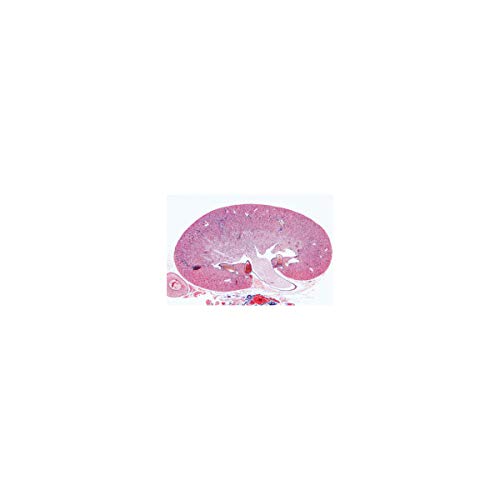 Image of 3B Scientific GmbH W13315 Urinary System-German