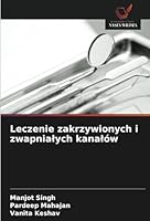 Tratamento de canais curvos e calcificados 6208671558 Book Cover