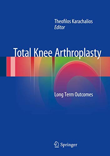 Total Knee Arthroplasty view 2