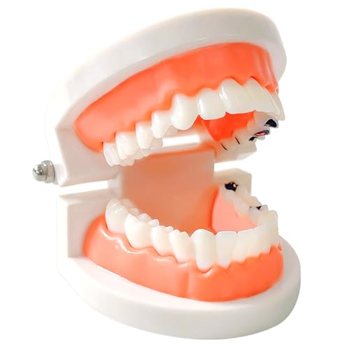 Ceonam - Dental Caries Teaching Model 1:1 Adult Life Size - Non-Removable Teeth Model for Education - Ideal for Demonstrations and Learning Dental Structures for Students Patients Professionals