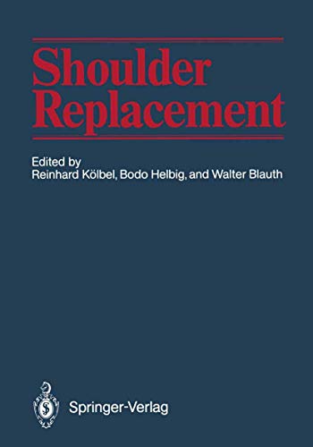 Shoulder Replacement view 2