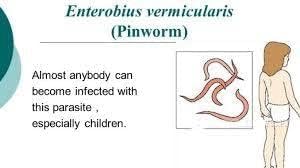 PCI Pinworm Test Kit: Accurate Detection for Anal Itching Caused by pinworms, Ideal for Anyone who has had Negative Results, Targets Peri-Anal Region, Includes 1 Pinworm Sticky Paddle Test kit