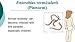 PCI Pinworm Test Kit: Accurate Detection for Anal Itching Caused by pinworms, Ideal for Anyone who has had Negative Results, Targets Peri-Anal Region, Includes 1 Pinworm Sticky Paddle Test kit