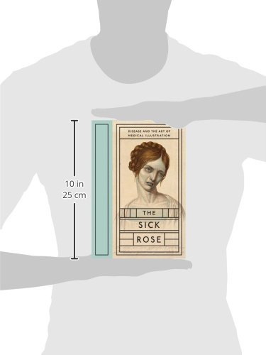 The Sick Rose: Disease and the Art of Medical Illustration