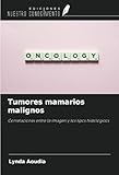 Tumores mamarios malignos: Correlaciones entre la imagen y los tipos histológicos