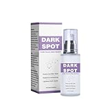Dark Spot Remover for Face and Body,Age Spot Remover for Face,Ideal for Sun Spots, Melasma,50ml