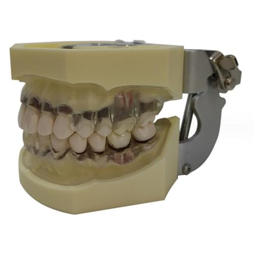 Modelo de práctica periodontal transparente, modelo de tipodontes dentales, para enseñanza de enfermedades periodontales, herramienta explicativa