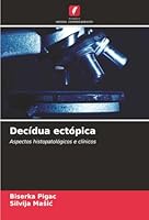 Decídua ectópica (Portuguese Edition) 6208909694 Book Cover