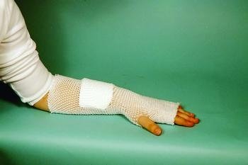 MT Spandage Tubular Elastic Dressing Retainer - 6; Small: head / Medium: shoulder, thigh - 1 Each miniatura 1