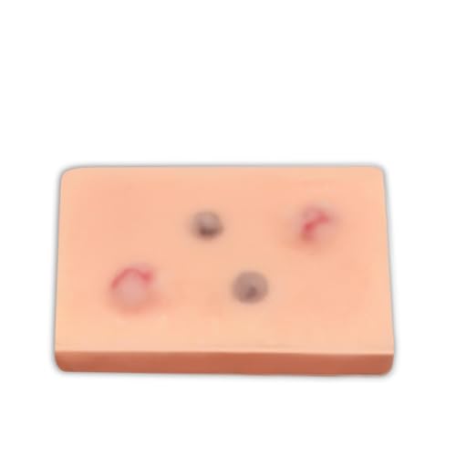 Skin Cyst Excision Training Model - Realistic Skin Lesion Model for Surgical Practice, Dermatology Training, and Cyst Removal Simulation.