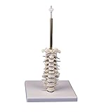  Schädelstativ Halswirbelsäule