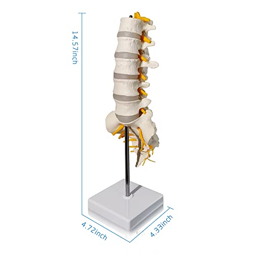 EVOTECH SCIENTIFIC Lumbar Spine Anatomy Model with Sacrum and Spinal Nerves, Didactic Replica of Lumbosacral Section with Nerves and A Herniated Disc at L4, Includes Base for Medical Teaching Display - Thumbnail 3