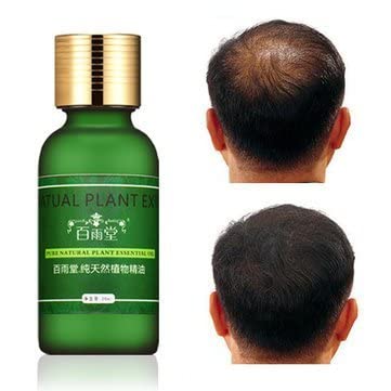 STORE99® Natural Plant Extract Rapid Hair Growth Essence Ginseng Ginger Herbal Pure