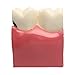 Dental Caries Tooth Model, YOUYA DENTAL 6 Times Caries Tooth Model Dental Anatomy Education Tooth Model Decay Teeth Comparative Study Model Teaching Typodont Model for Dentists Student Education