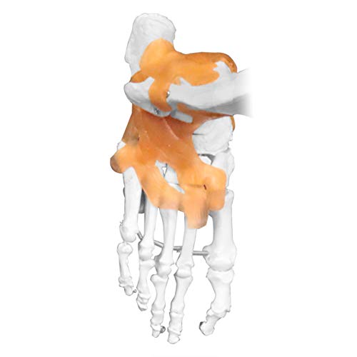 Vision Scientific Vas215-Dc Medical Grade, Full Size Skeleton W Hand Painted Muscles & Ligaments | Thick Zip Dust Cover | Skeleton Wired For Natural Movement | Mounted On Roller Stand W Manual #TOP6