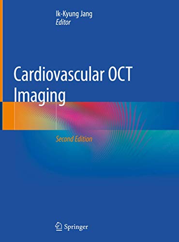 Cardiovascular OCT Imaging view 2